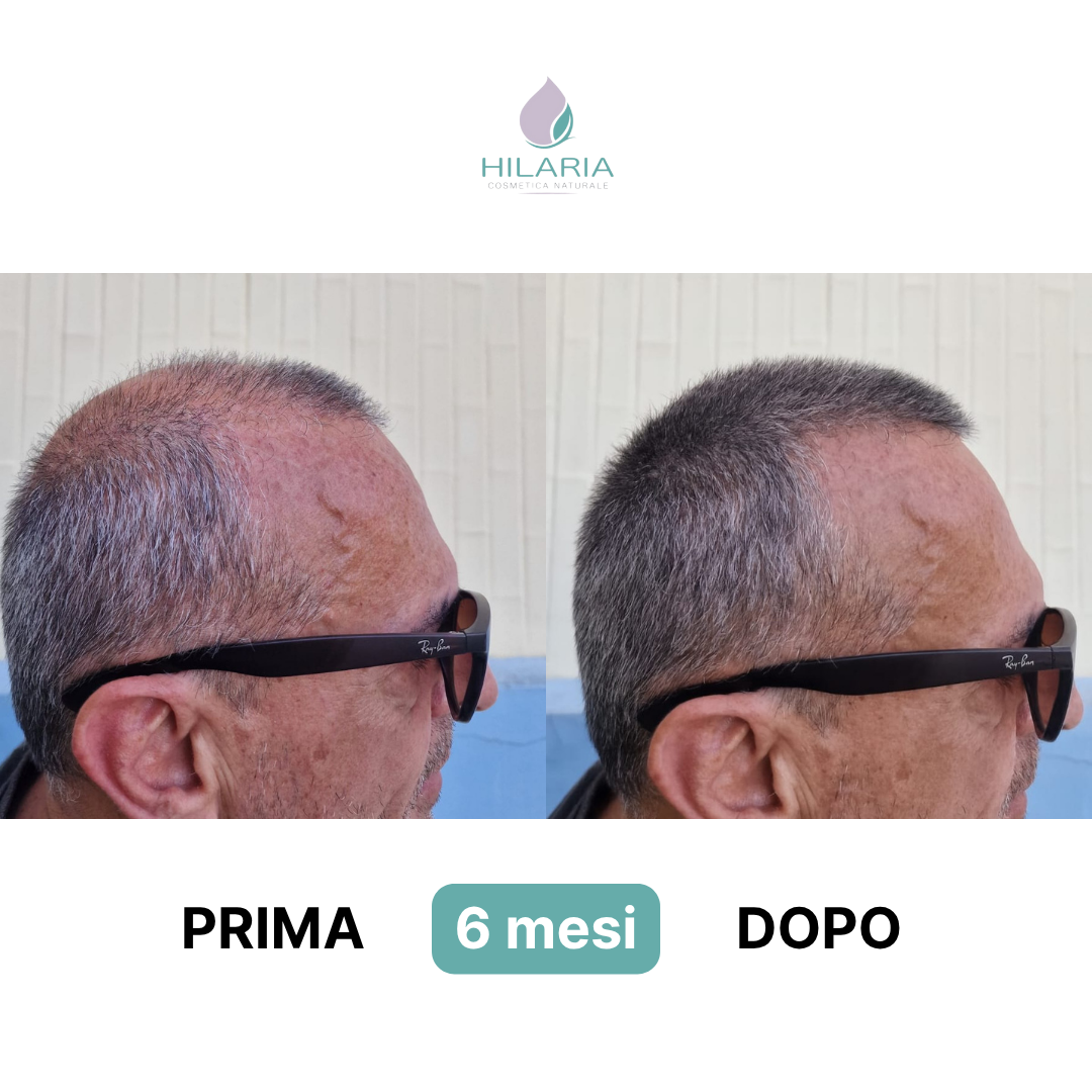 Routine a base di Cellule Staminali Naturali per capelli fragili e diradati | Trattamento Avanzato con Shampoo + Lozione