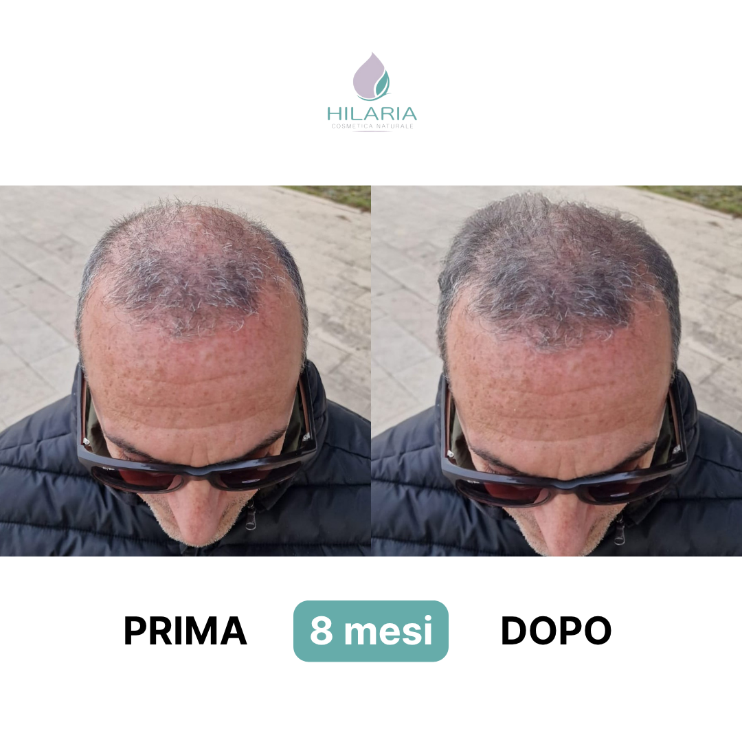 Efficacia Routine Anticaduta Hilaria Cosmetics