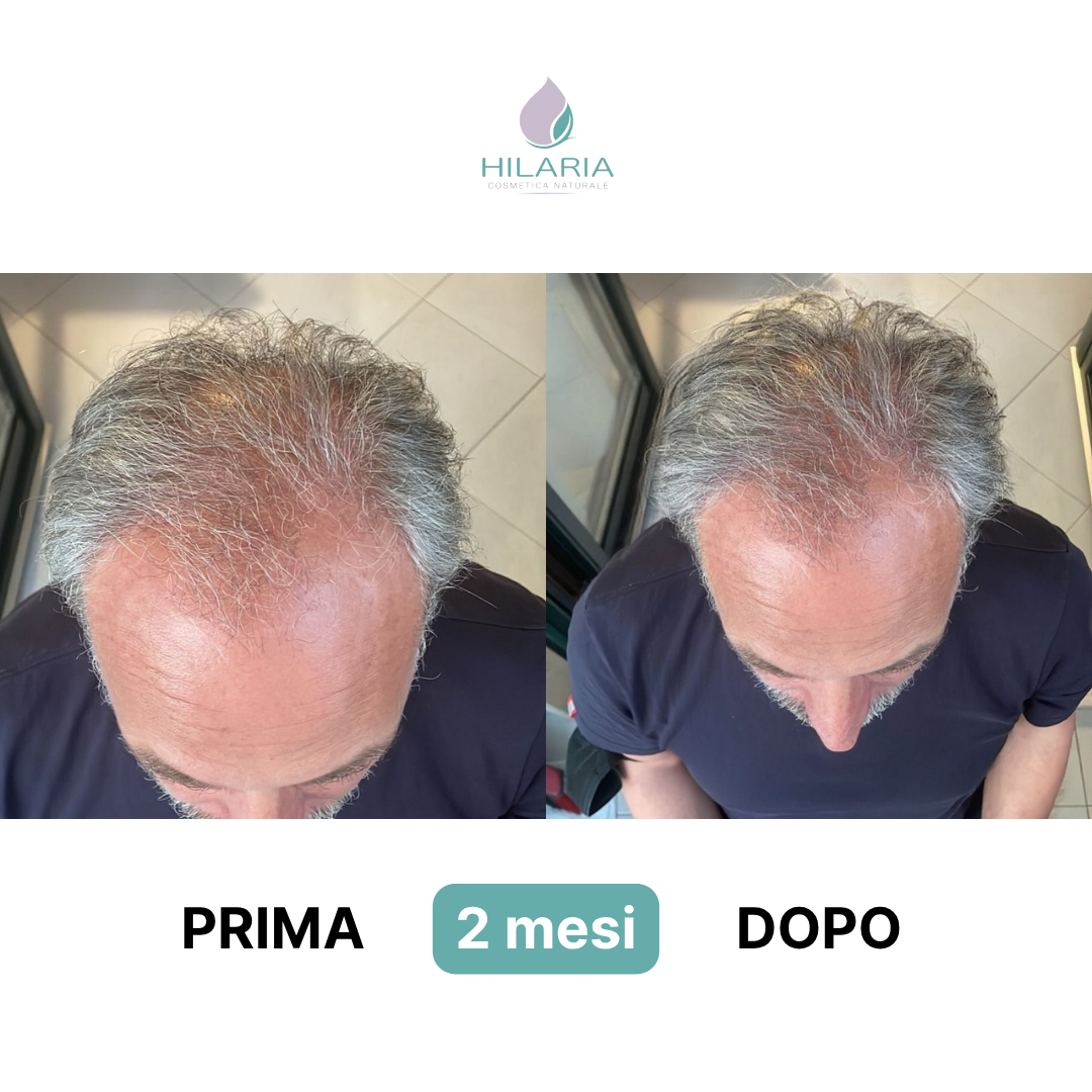 Routine a base di Cellule Staminali Naturali per capelli fragili e diradati | Trattamento Avanzato con Shampoo + Lozione