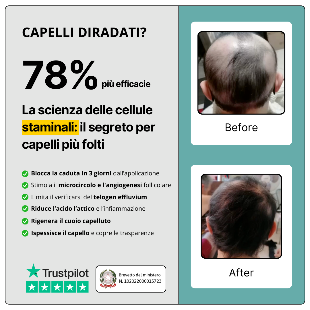 BUNDLE TOP: Routine a base di Cellule Staminali Naturali per capelli fragili e diradati | Trattamento Avanzato con Shampoo + Lozione