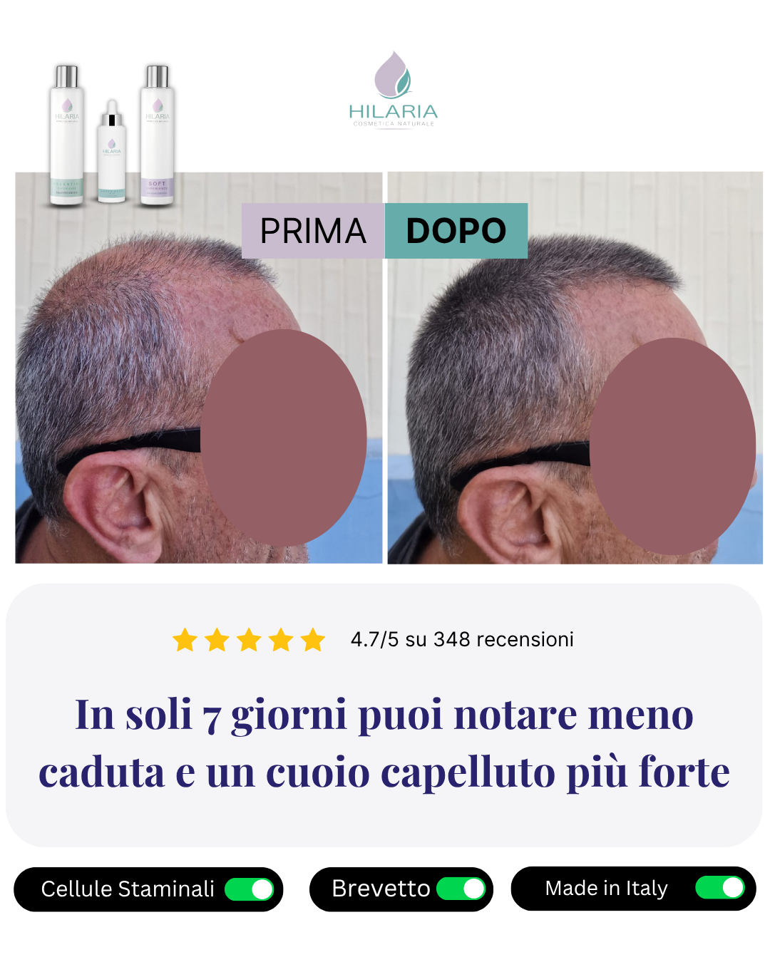 Routine a base di Cellule Staminali Naturali per capelli fragili e diradati | Trattamento Avanzato con Shampoo + Lozione