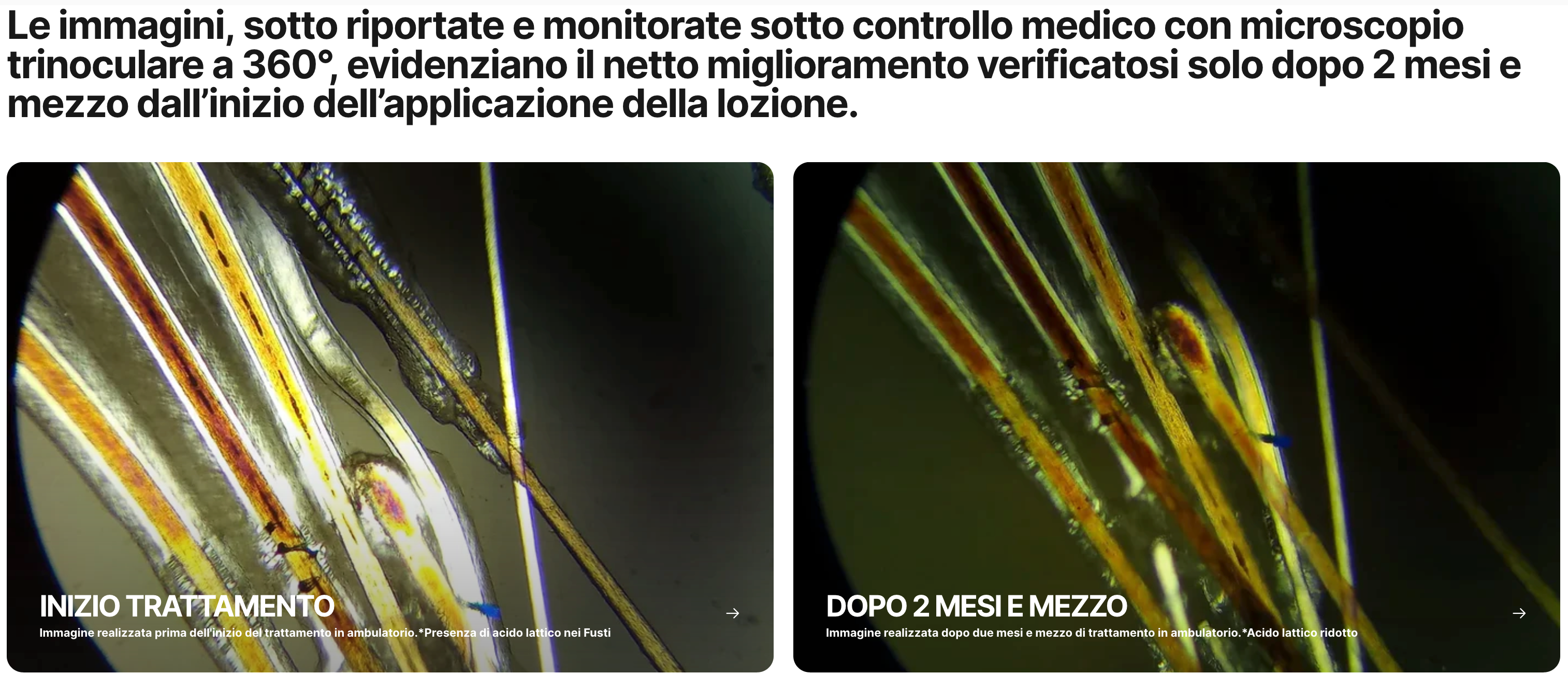 Routine a base di Cellule Staminali Naturali per capelli fragili e diradati | Trattamento Avanzato con Shampoo + Lozione