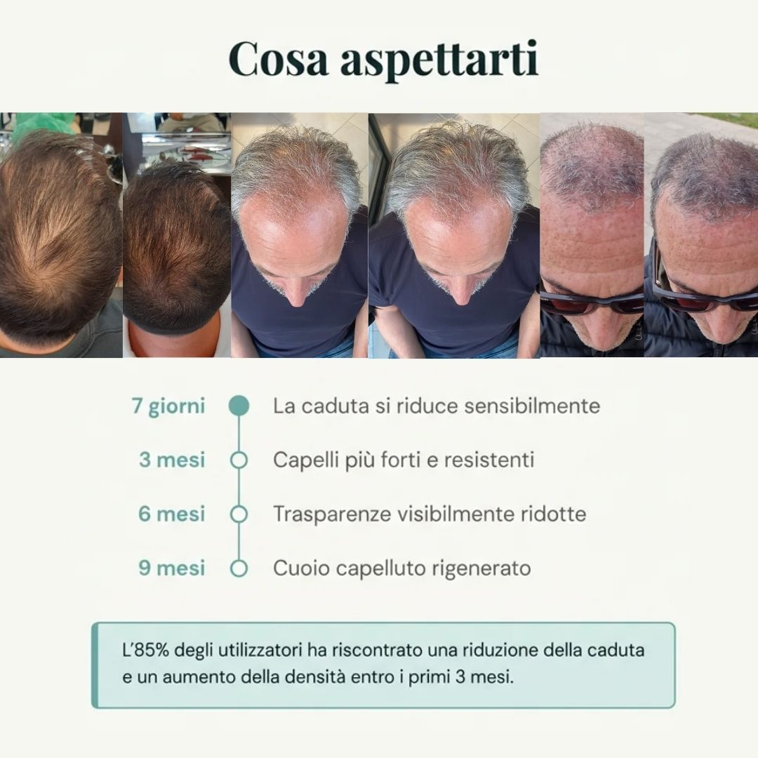 Routine Capelli Anticaduta con Cellule Staminali Vegetali | Shampoo + Lozione