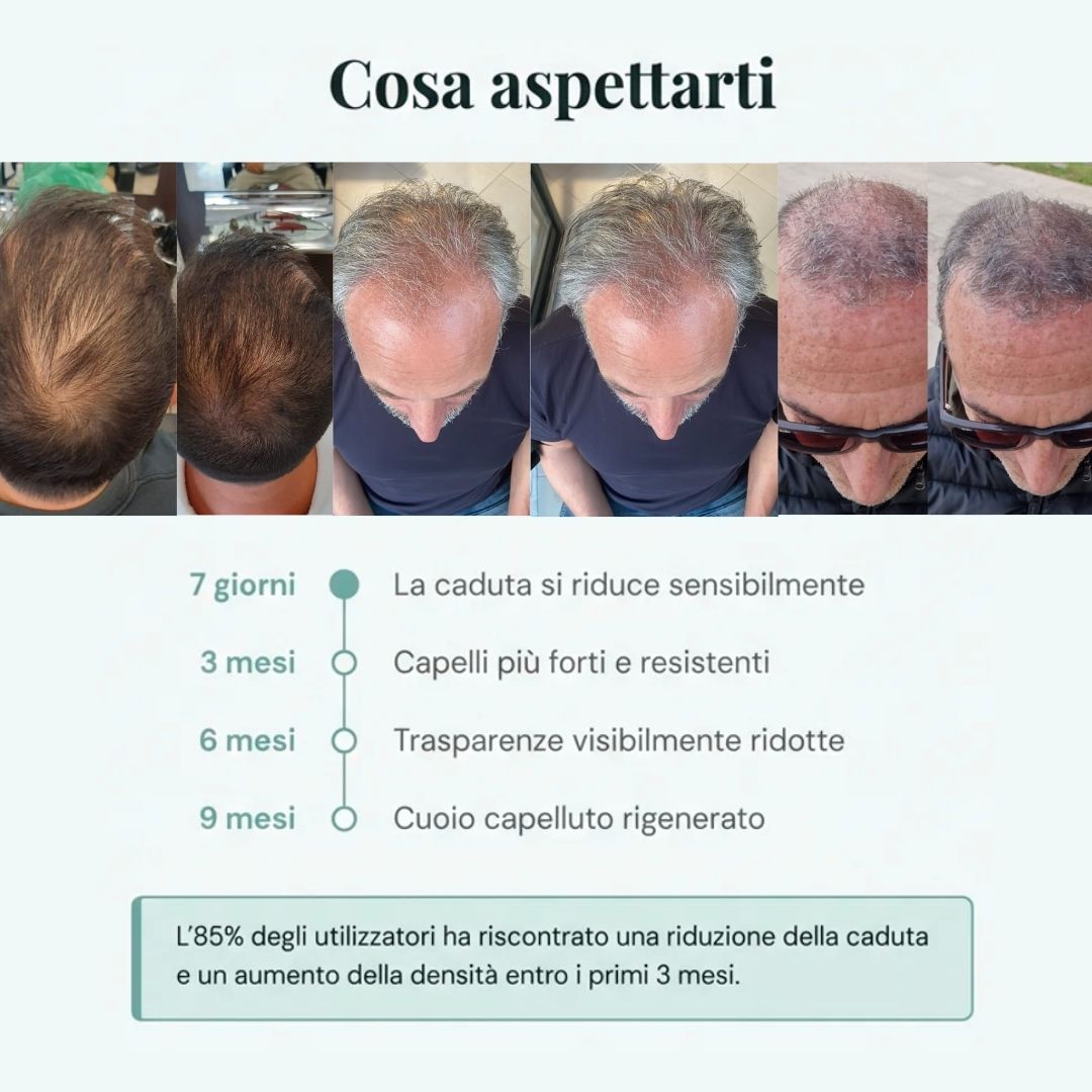 Routine Capelli Anticaduta con Cellule Staminali Vegetali: Shampoo e Lozione