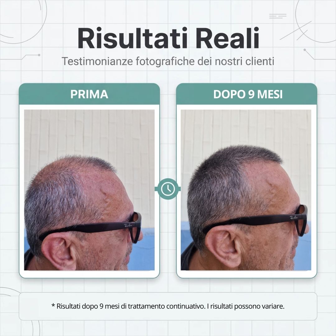 Routine Capelli Anticaduta con Cellule Staminali Vegetali: Shampoo e Lozione