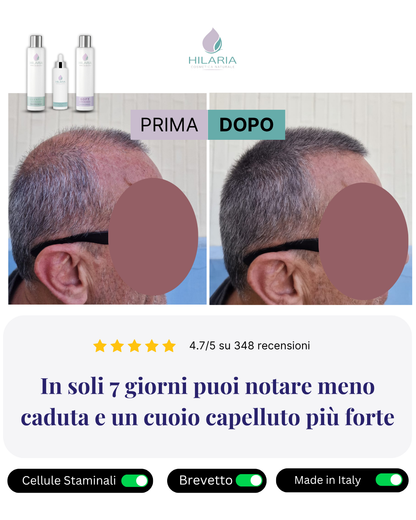 Routine a base di Cellule Staminali Naturali per capelli fragili e diradati | Trattamento Avanzato con Shampoo + Lozione