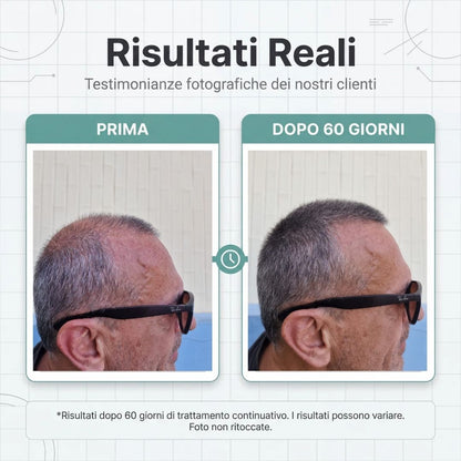 Routine Capelli Anticaduta con Cellule Staminali Vegetali | Shampoo + Lozione